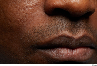 HD Face Skin Najeem Bonner face lips mouth nose scar…
